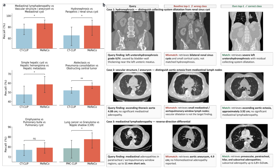 Examples of retrieval outcomes for clinically confusable cases.