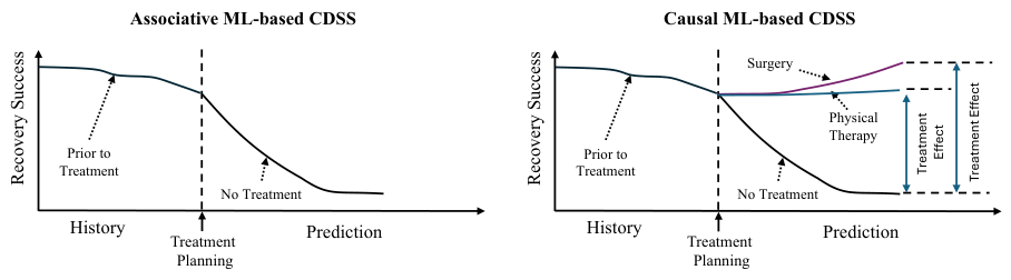 Visualization of the difference between an associative ML-based CDSS and a causal ML-based CDSS.