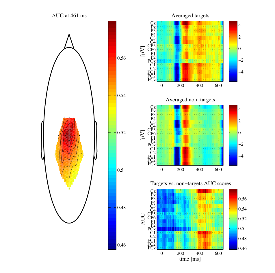 Topographic plot of electrode placements.