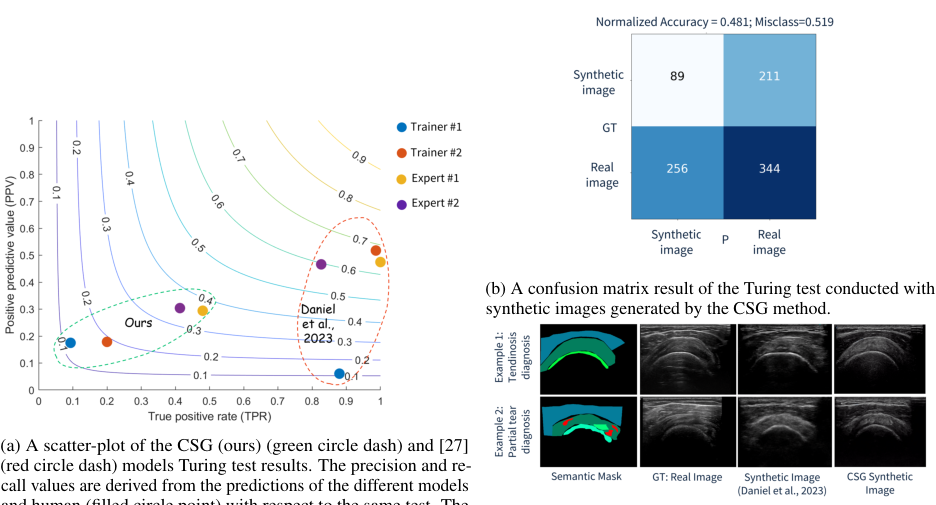 Generated ultrasound images based on geometry semantic masks and different context images.