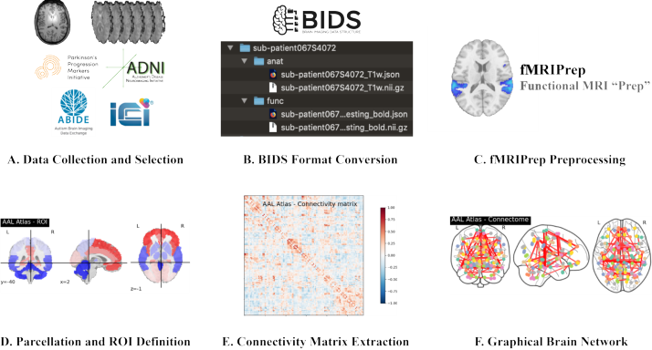 Figure 1: Brain Network Construction Pipeline